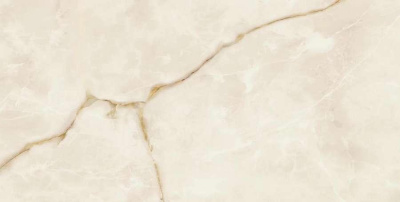 Symphonyx Gold Lap. 80x160 Керамогранит